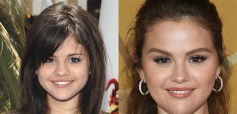 selena gomez boobs before and after|Selena Gomez Addresses Her Body Transformation With A。